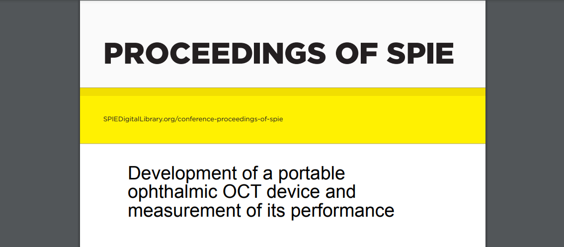 Development of a portable ophthalmic OCT device and measurement of its performance